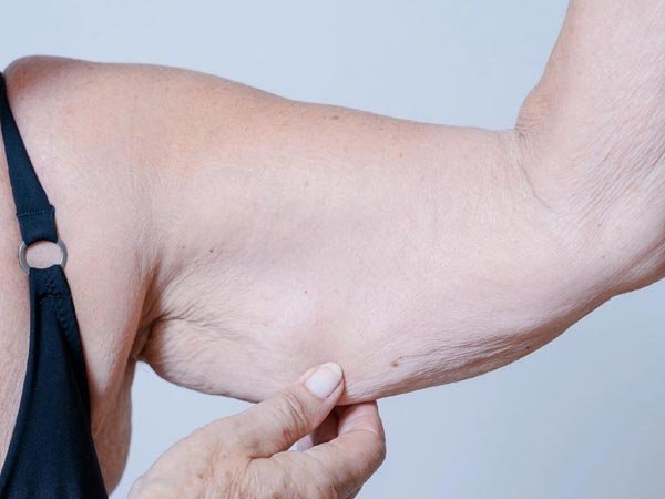 dicas para prevenir e tratar a sarcopenia